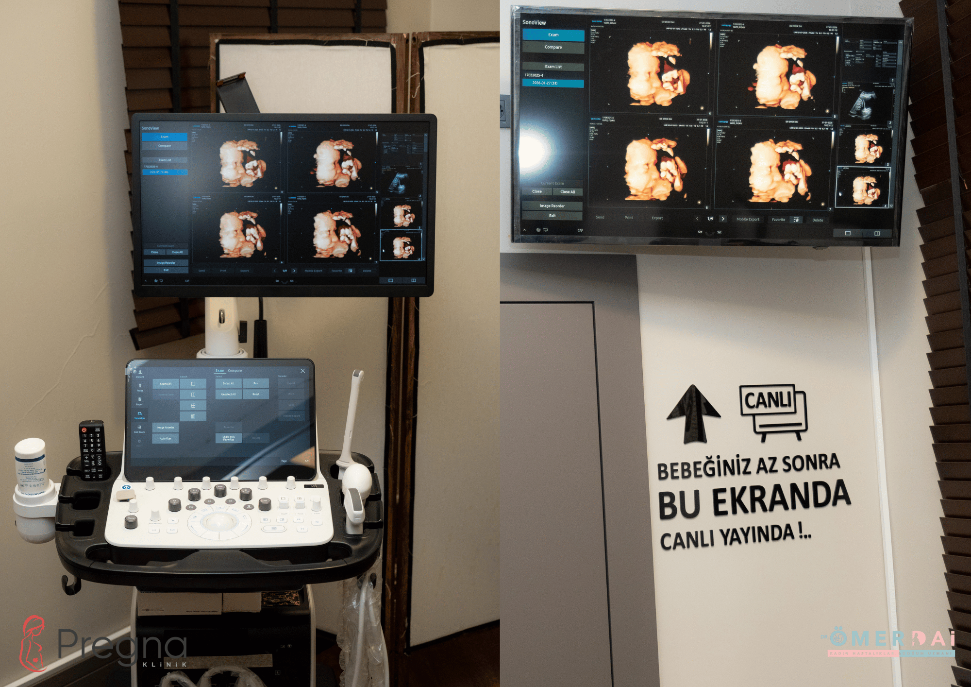 Samsung V8 Ultrason ile Üst Düzey Görüntüleme: Pregna Klinik Gaziantep’te İleri Teknoloji Gebelik Takibi