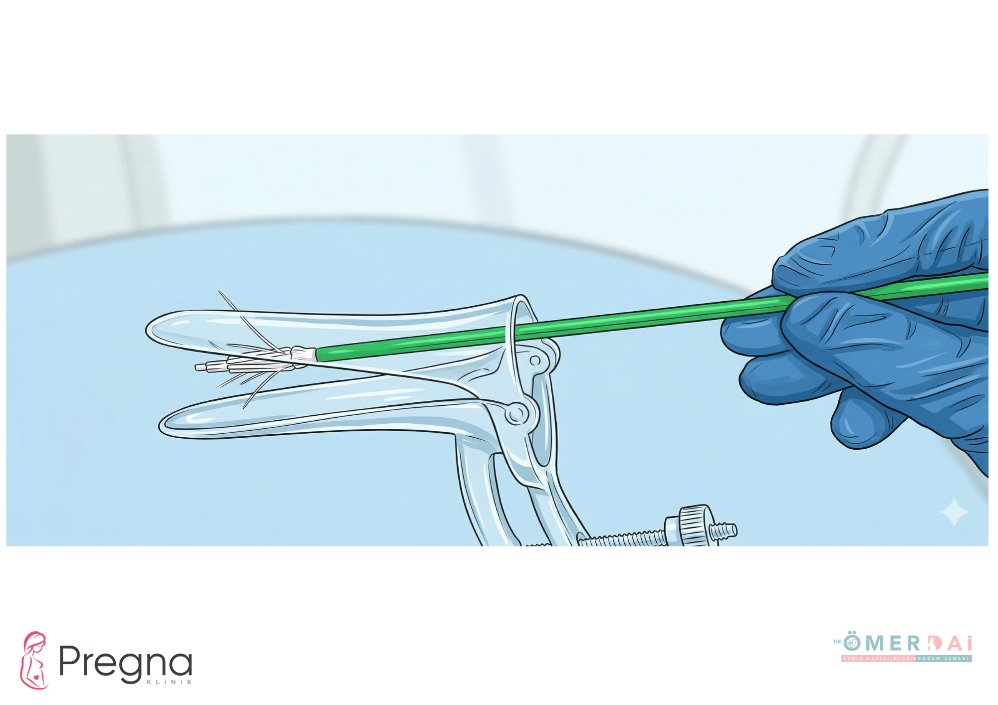 HPV Testi Nedir? Kaç Yılda Bir Yapılmalı? Gaziantep’te Ağrısız HPV ve Smear Testi